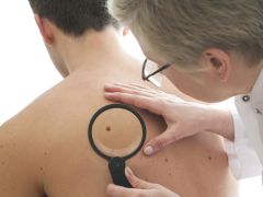 Popular Misconceptions About Skin Cancer Debunked